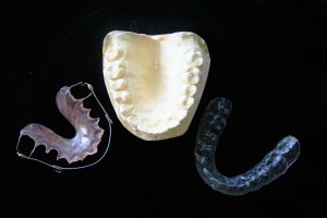 teeth straightening options