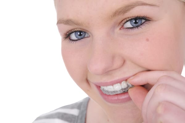 Invisalign Teen