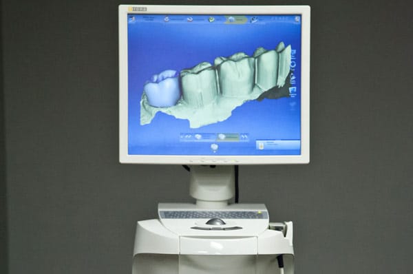 Cone Beam Dental Imaging
